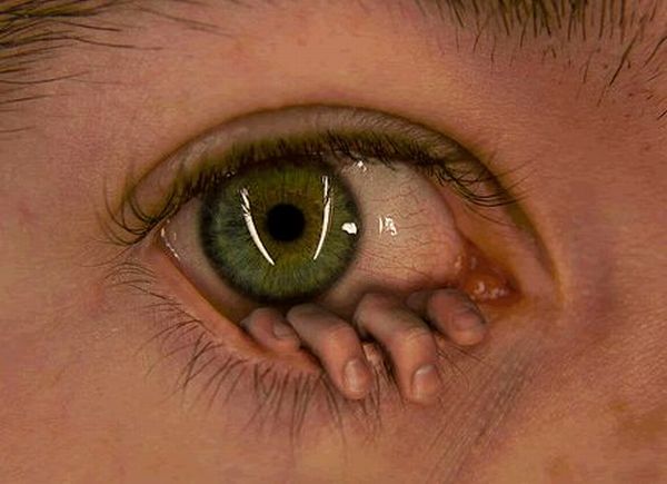 Hand in Eye